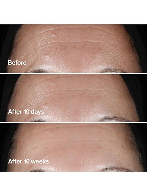 Smart Clinical Repair™ Wrinkle Correcting Serum商品第3张图片规格展示