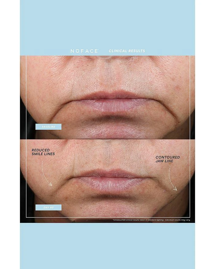 商品NuFace|Trinity+ Facial Toning Device & Primer,价格¥2916,第3张图片详细描述