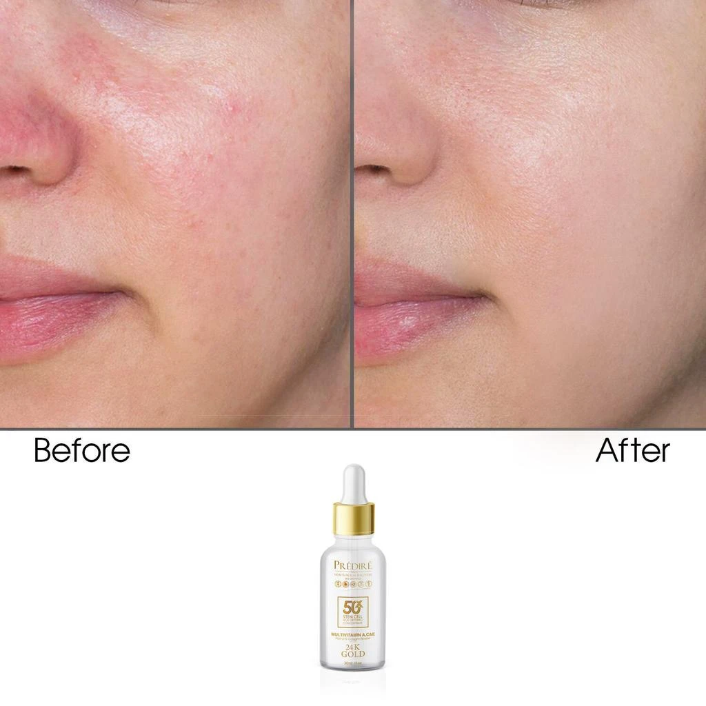 商品Predire Paris|50X Multivitamin A, C, & E Stem Cell Age Defying 24K Gold Serum,价格¥266,第2张图片详细描述