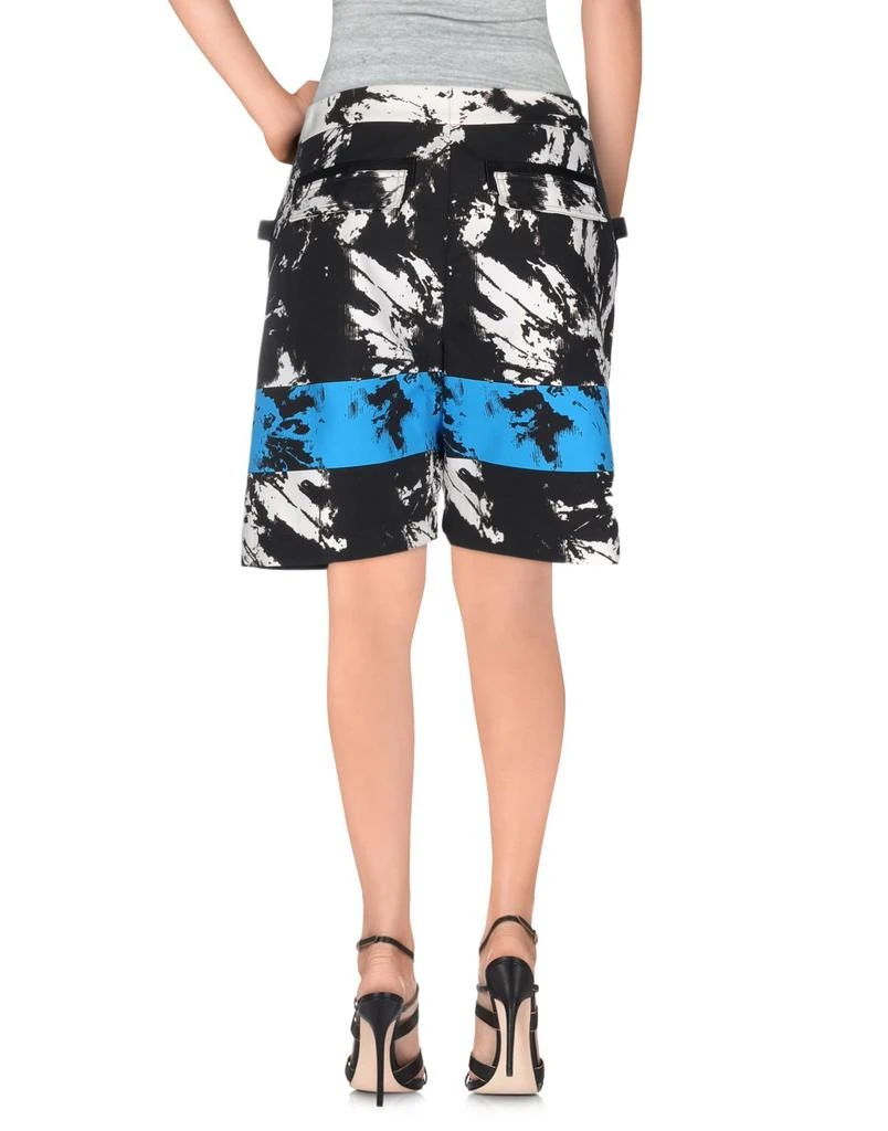商品Alexander Wang|Shorts & Bermuda,价格¥1144,第2张图片详细描述