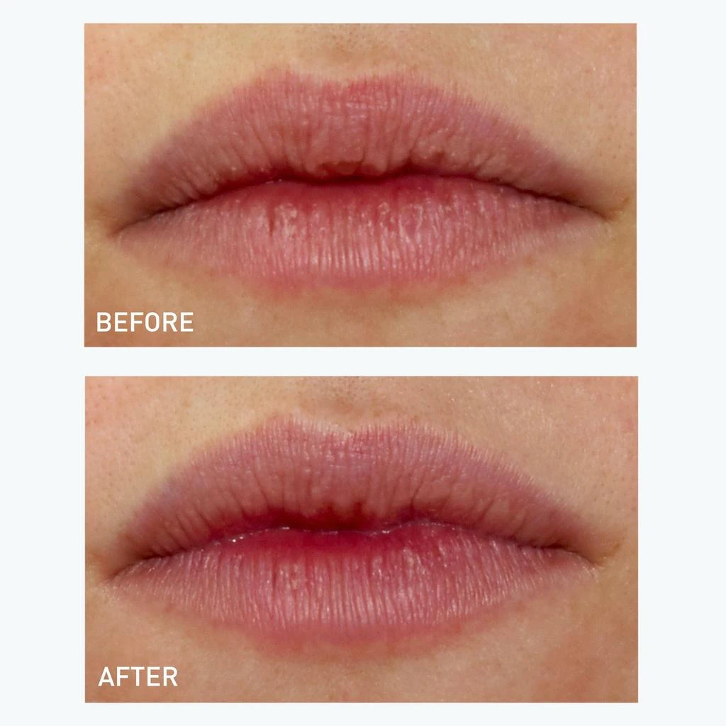 商品skyn ICELAND|Plumping Lip Gels,价格¥114,第4张图片详细描述