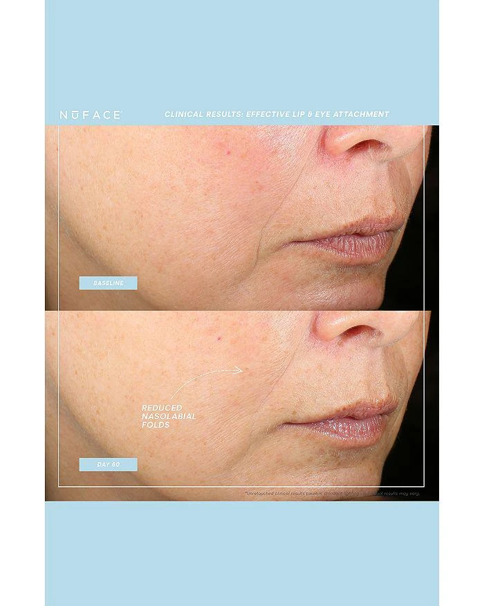 商品NuFace|Effective Lip & Eye Trinity+ Attachment,价格¥1196,第4张图片详细描述