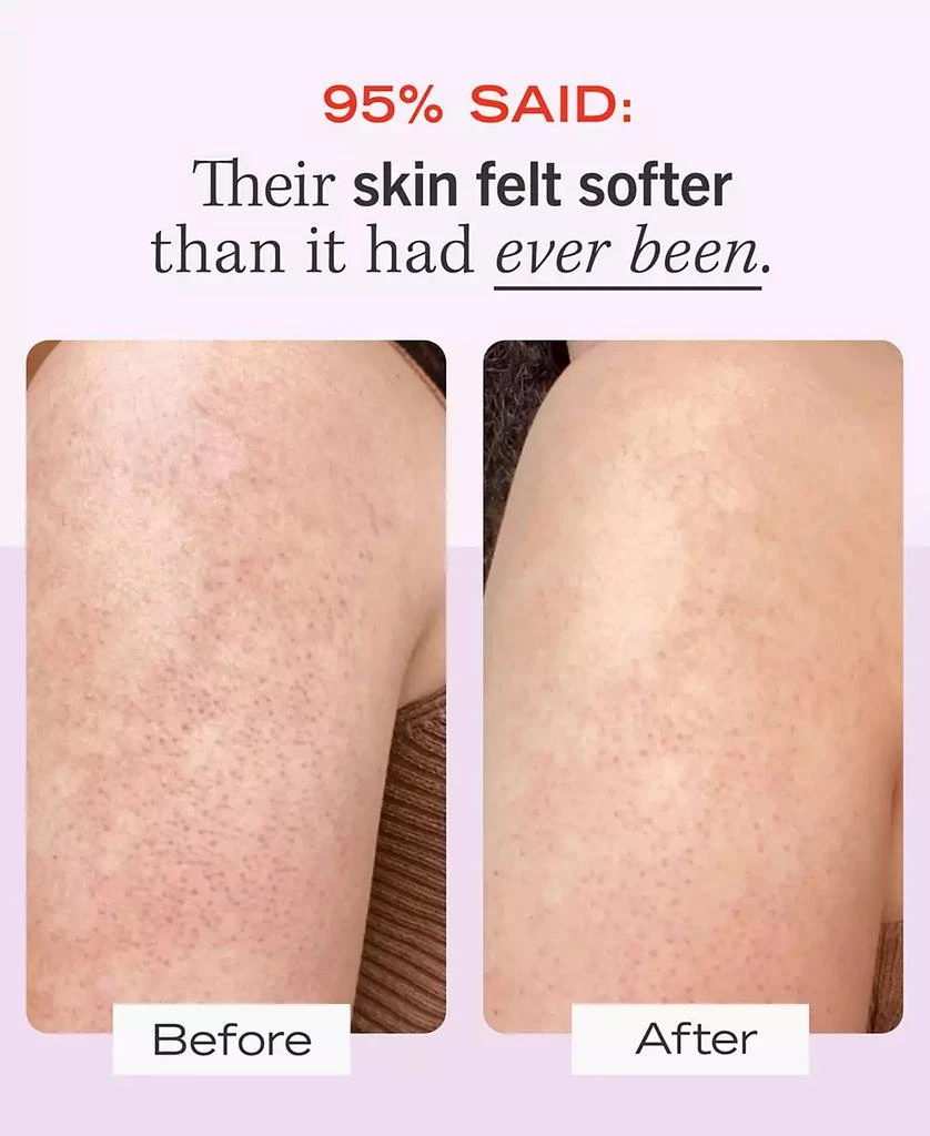 KP Bump Eraser Body Scrub with 10% AHA – Body Exfoliant for Keratosis Pilaris, 8.0 oz. 商品