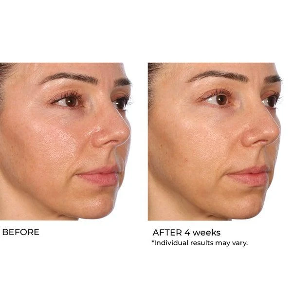 NassifMD Dermaceuticals Hydro-Gel with Hyaluronic Acid, Retinol and Salicylic Acid 50ml 商品
