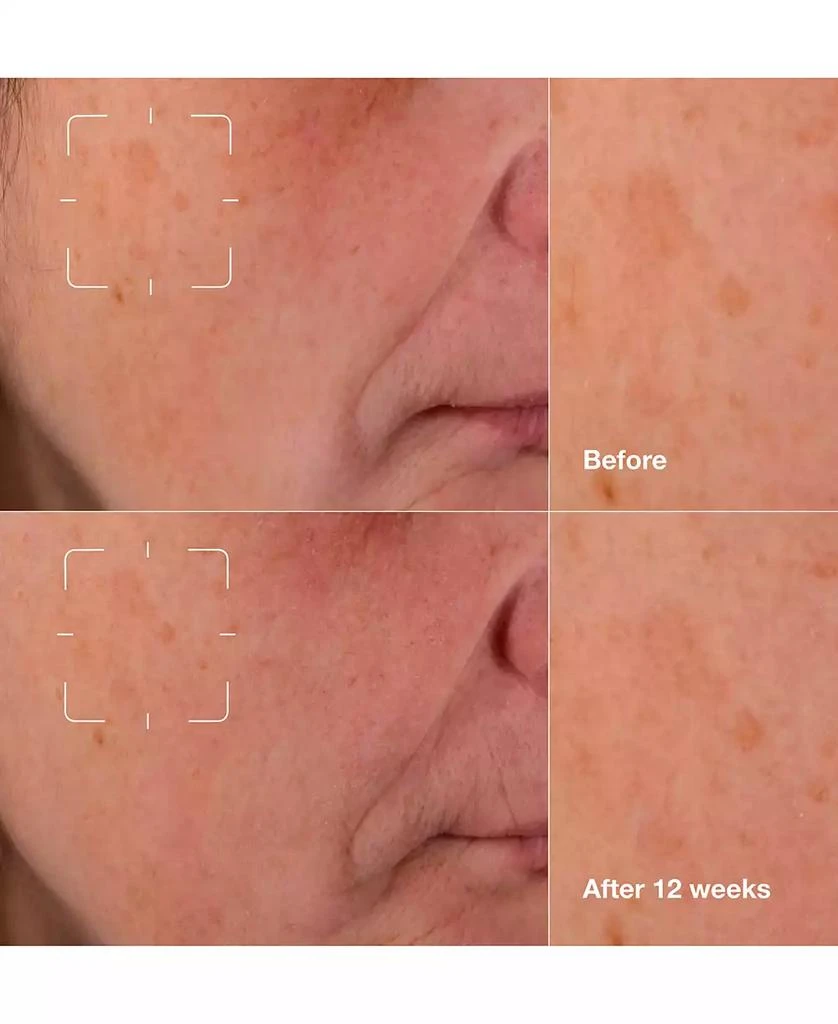 商品Clinique|Even Better Clinical Dark Spot Clearing Serum with Vitamin C,价格¥469,第5张图片详细描述