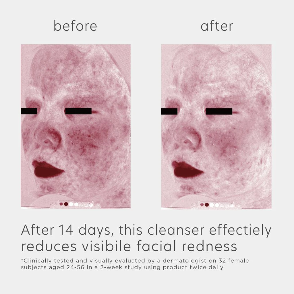 EltaMD Skin Recovery Amino Acid Foaming Cleanser 商品