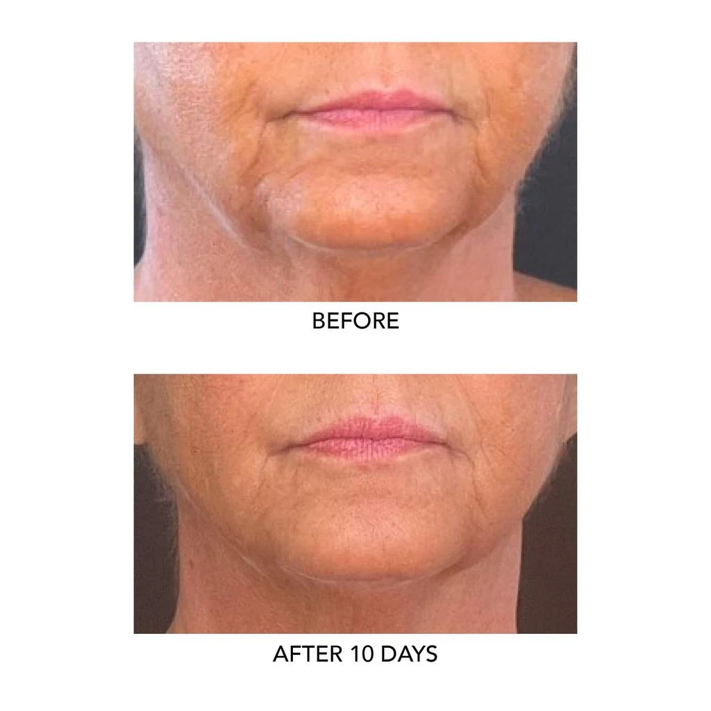 商品Algenist|GENIUS Liquid Collagen®,价格¥193,第3张图片详细描述