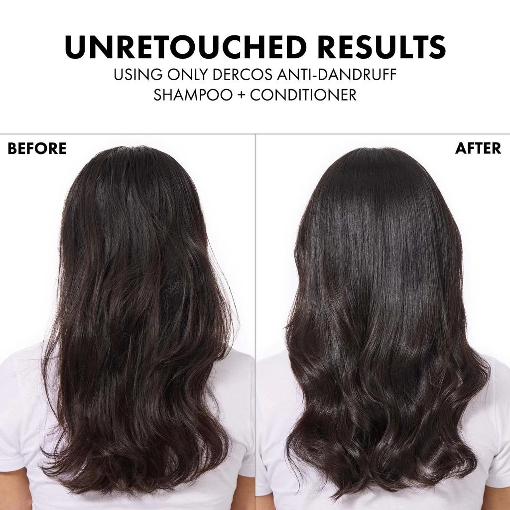 Vichy Dercos Selenium Sulfide Anti-Dandruff Shampoo 商品