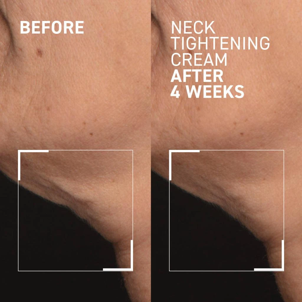 商品Dr. Brandt Skincare|NECK TIGHTENING CREAM + GUA SHA,价格¥691,第2张图片详细描述