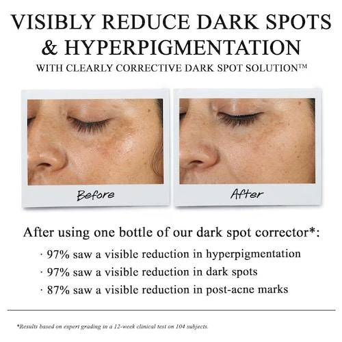 Clearly Corrective Dark Spot Correcting Serum 商品