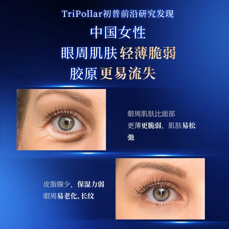 TriPollar/初普Miracle Young奇迹青春淡纹紧致眼部射频美眼仪 1件装 商品