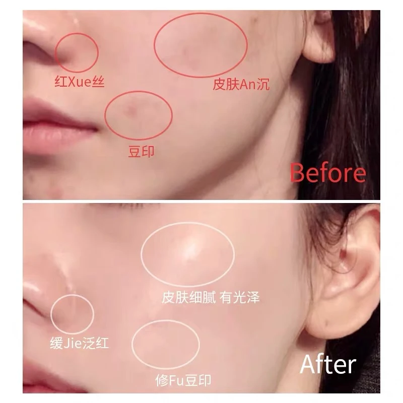 Lancome【买赠活动】兰蔻肌底焕活修护小黑瓶精华液100ml修护淡纹抗老化 商品