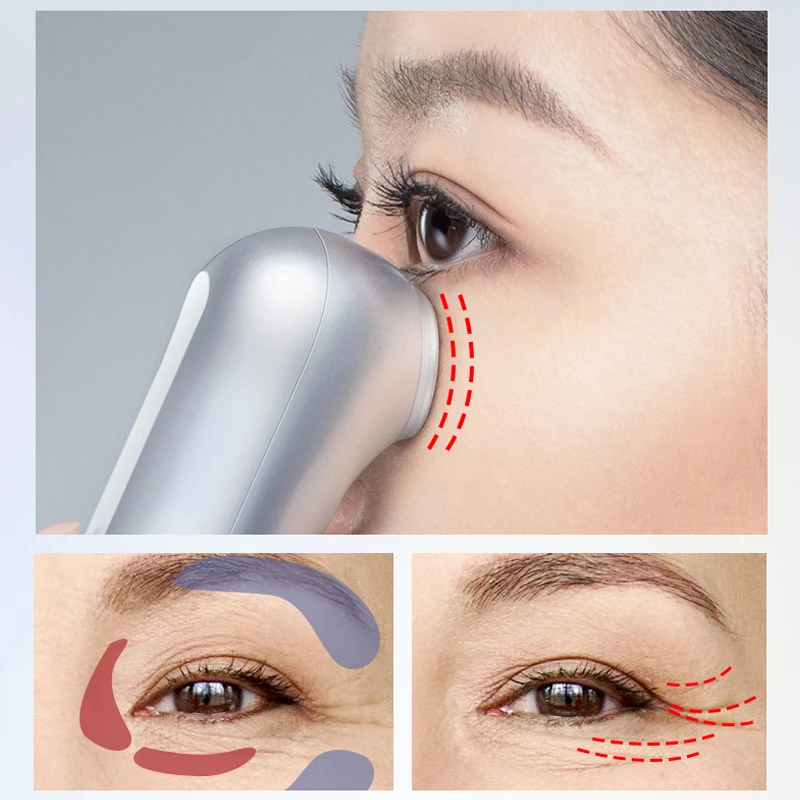 雅萌ACE Eye眼部射频美容仪提拉眼周美眼仪 商品