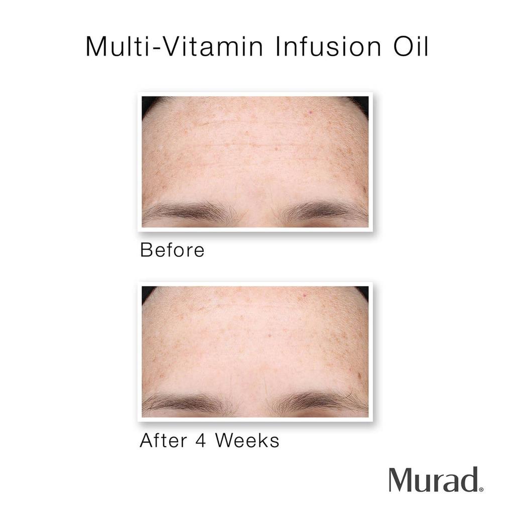 Murad Hydrate Trial Kit (Worth $58.00)商品第3张图片规格展示