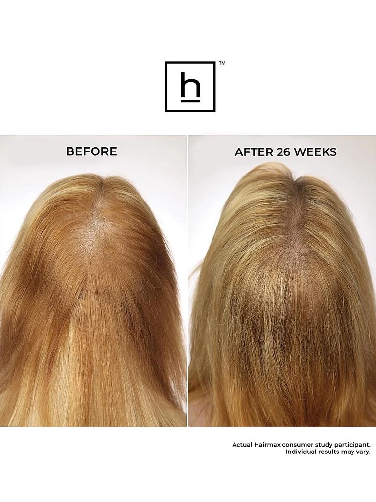 商品HairMax|Laserband 82 Comfortflex Hair Growth Device,价格¥6277,第5张图片详细描述