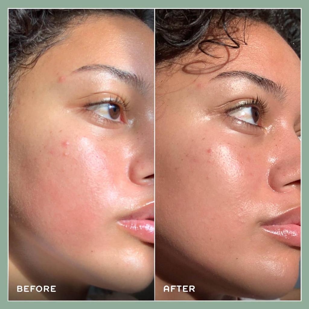 商品REN Clean Skincare|REN Clean Skincare Evercalm Redness Relief Serum 1fl. oz.,价格¥439,第6张图片详细描述