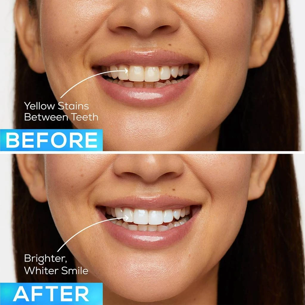 GLO Science GLO Brilliant Teeth Whitening GLO Vials Refills 商品