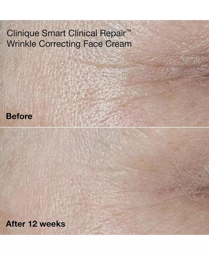 Wrinkle-Fighting Routine Skin Care Gift Set 商品