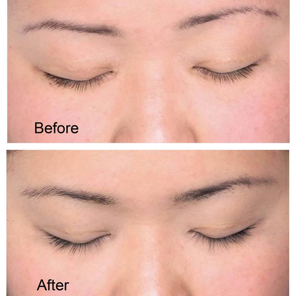 商品RapidLash|RapidLash Eyelash Enhancing Serum,价格¥322,第3张图片详细描述
