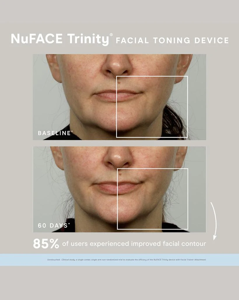 商品NuFace|Limited-Edition Trinity Microcurrent Skincare Regimen ($473 Value),价格¥1556,第3张图片详细描述