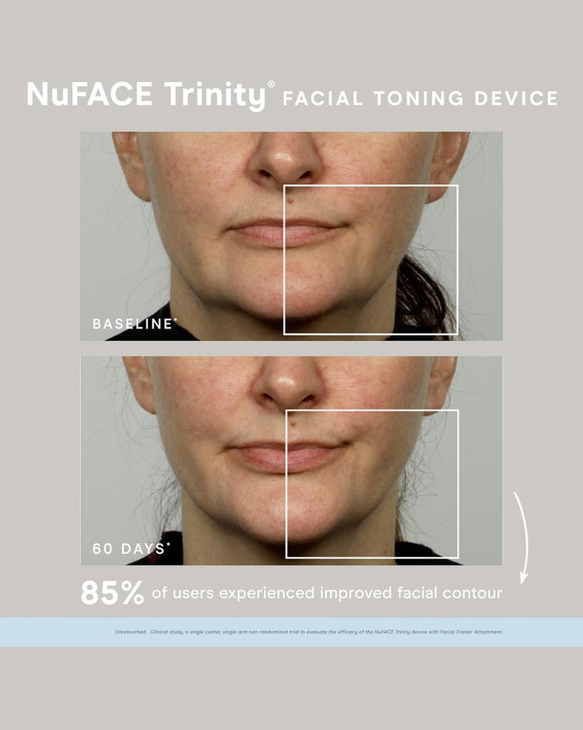 商品NuFace|Limited-Edition Trinity Microcurrent Skincare Regimen ($473 Value),价格¥2496,第5张图片详细描述