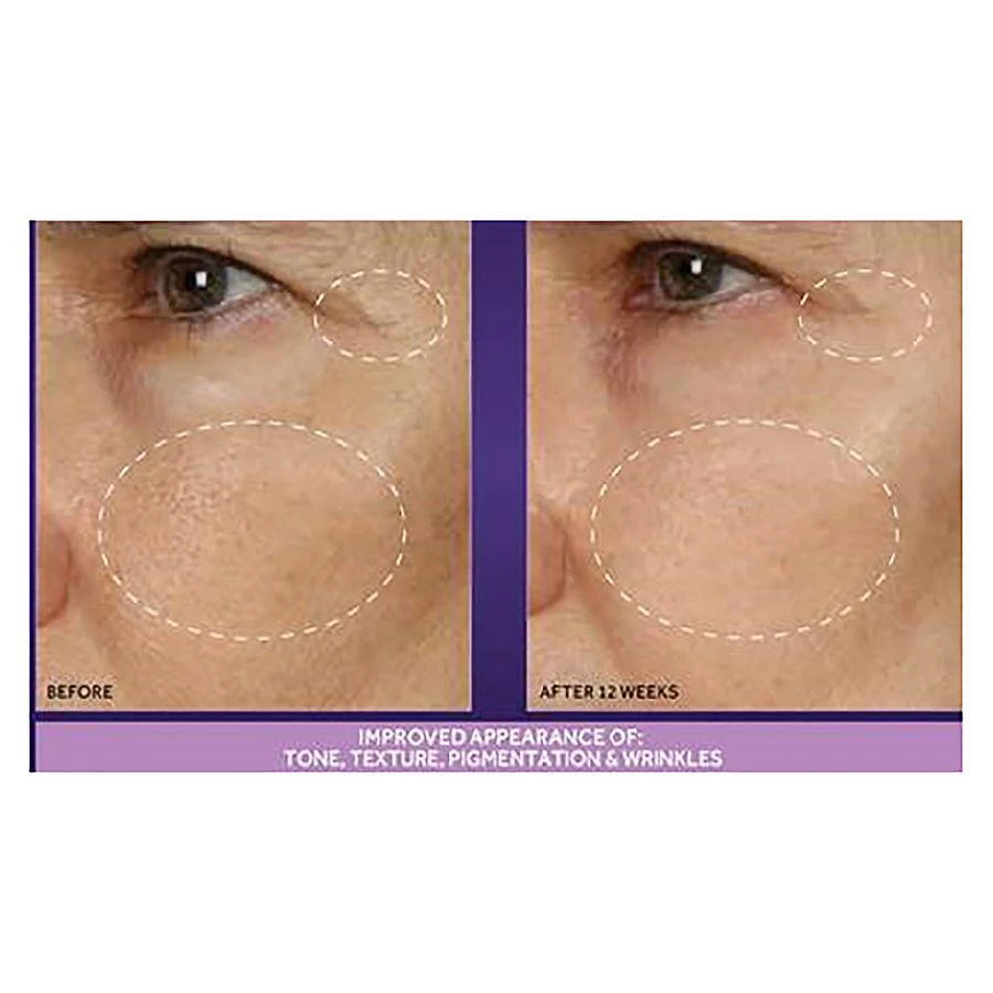 Advanced Retinol 1.5% Complex Night Concentrate 商品
