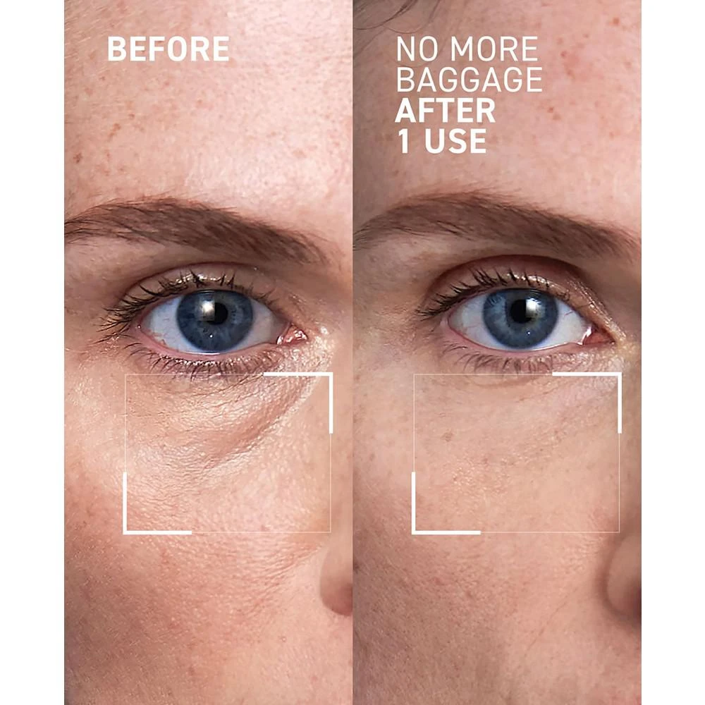 商品Dr. Brandt Skincare|Needles No More No More Baggage Eye Gel, 0.5 oz.,价格¥359,第2张图片详细描述
