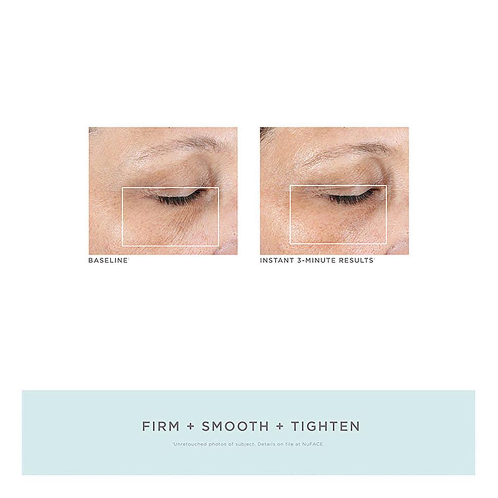 商品NuFace|NuFACE FIX Line Smoothing Device,价格¥713,第7张图片详细描述