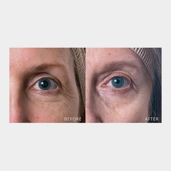 商品skyn ICELAND|skyn ICELAND Hydro Cool Firming Eye Gels,价格¥275,第3张图片详细描述