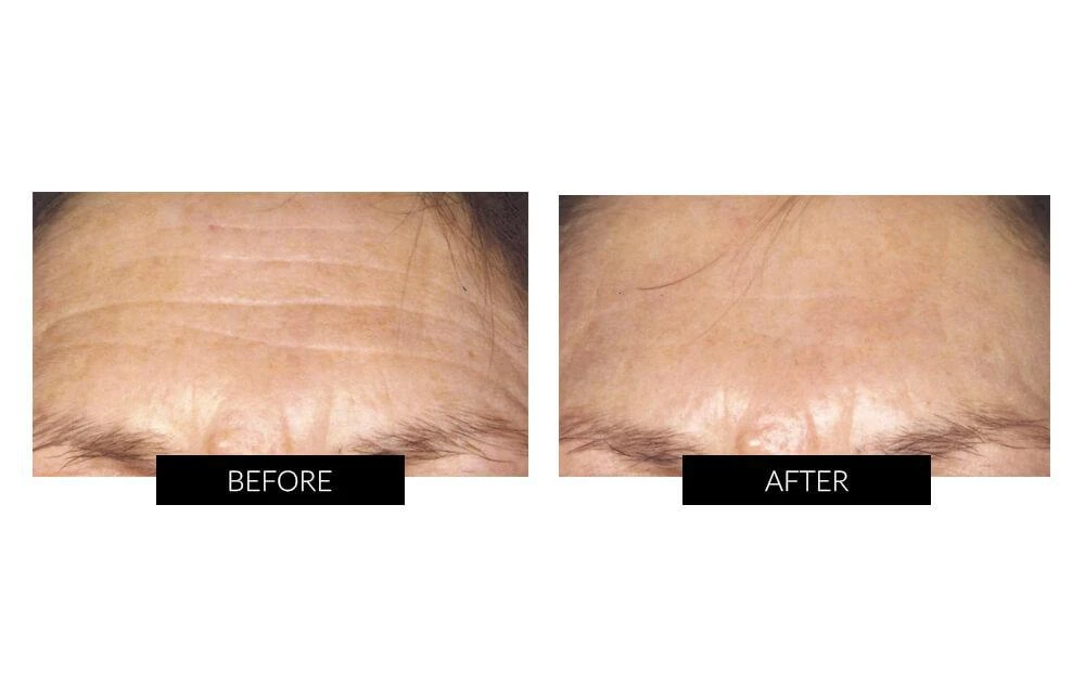 商品CurrentBody Skin|CurrentBody Skin Face & Neck Kit (worth 719).Hongmall,价格¥4635,第3张图片详细描述