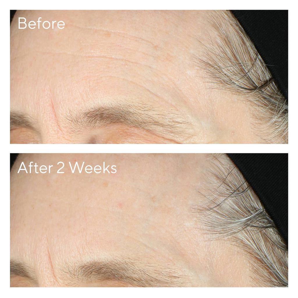 商品Murad|Murad Intense Recovery Cream 50ml,价格¥616,第7张图片详细描述