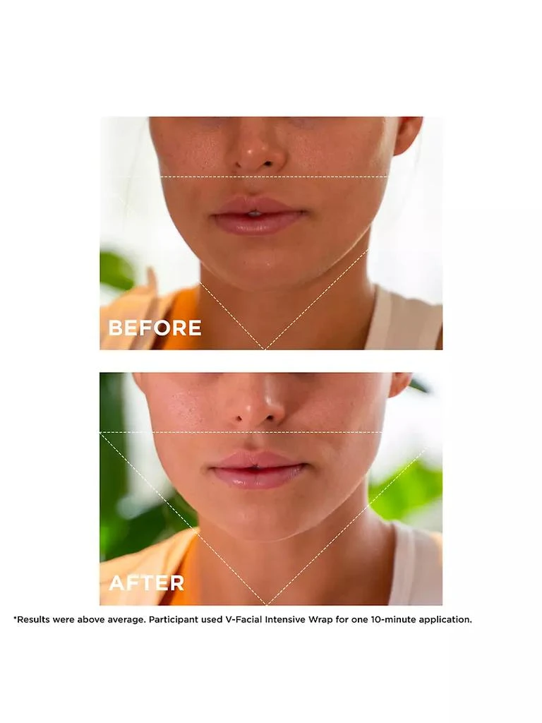 商品Clarins|V-Facial Instant Depuffing Face Mask,价格¥520,第4张图片详细描述