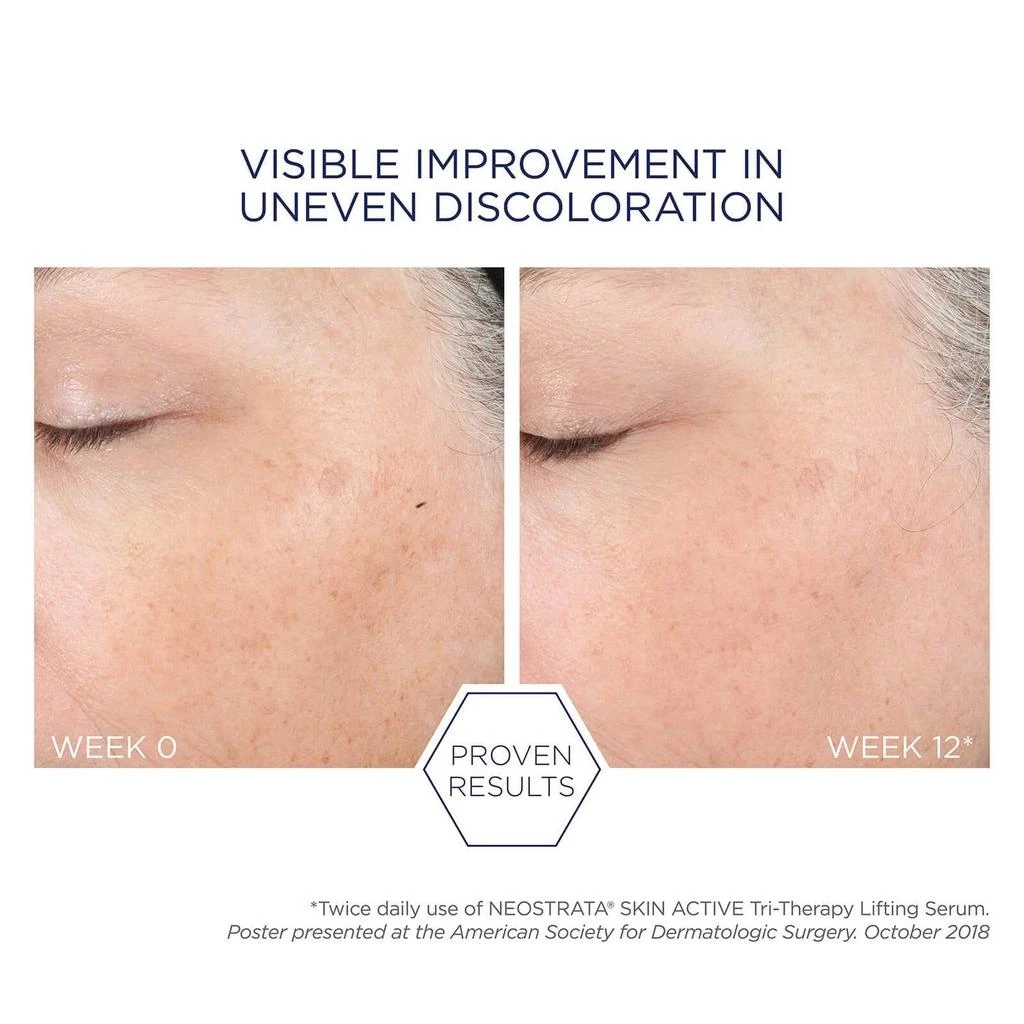 商品NeoStrata|Neostrata Skin Active Tri-Therapy Lifting Serum with Hyaluronic Acid 30ml,价格¥734,第4张图片详细描述
