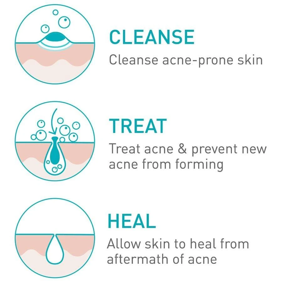 Acne Foaming Cream Face Cleanser for Sensitive Skin 商品