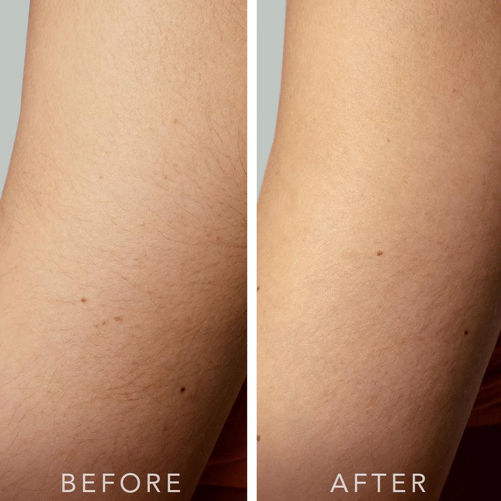 商品Foreo|FOREO PEACH 2 Advanced IPL Hair Removal Device,价格¥2096,第4张图片详细描述
