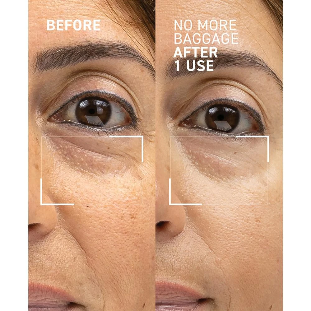 Needles No More No More Baggage Eye Gel, 0.5 oz. 商品