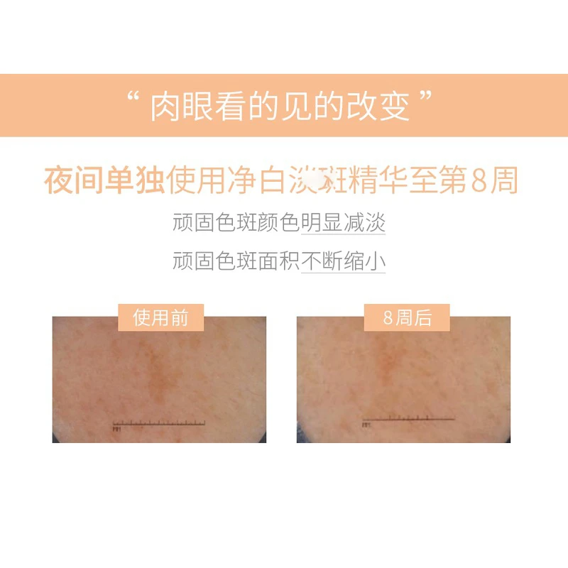 Bioderma贝德玛净白淡斑精华液15ml 商品