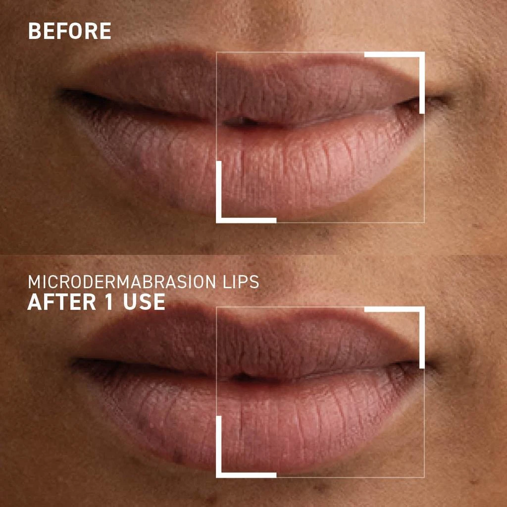 SMOOTHING LIP EXFOLIATOR 商品