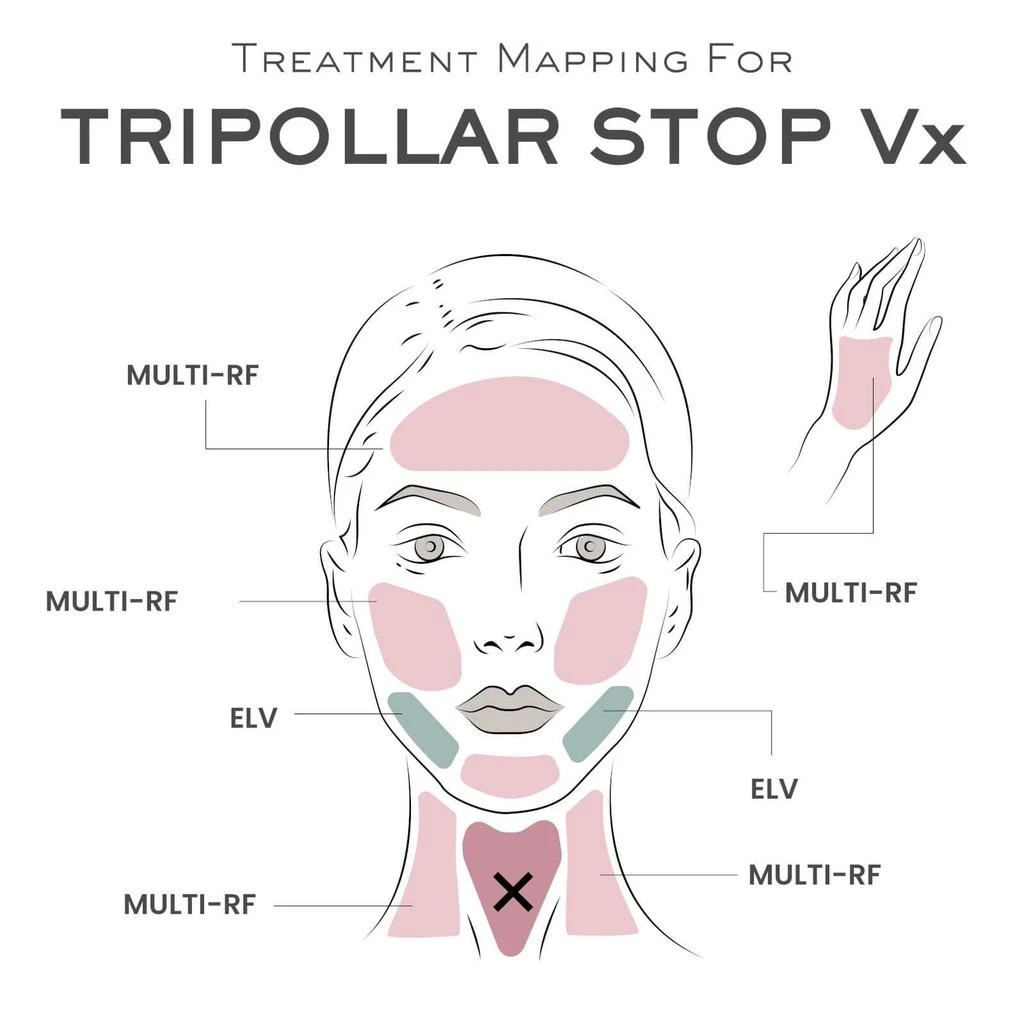 TriPollar STOP Vx 商品
