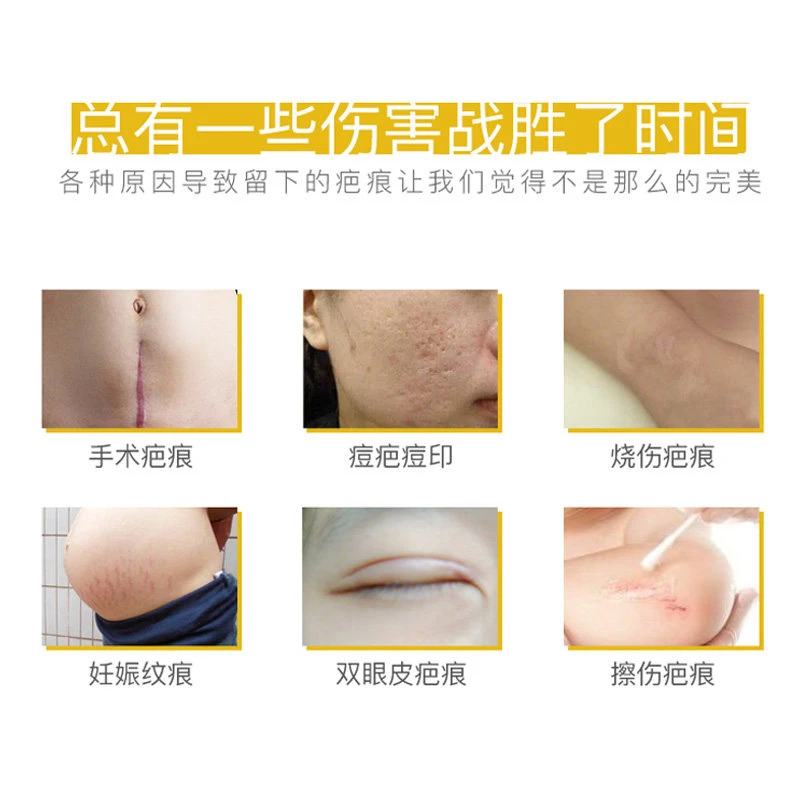 德国Contractubex秀碧祛疤膏除疤膏修复疤痕30g 港版正品去疤膏 商品