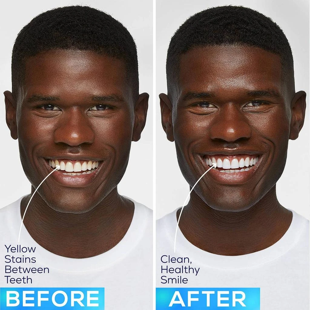 商品glo|GLO Science GLO Brilliant Teeth Whitening GLO Vials Refills,价格¥539,第5张图片详细描述