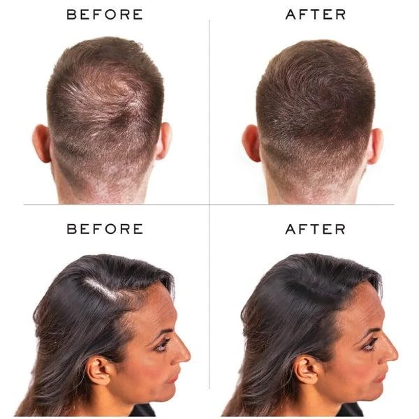 商品NANOGEN|Nanogen Hair Thickening Fibers Black (1.05 oz.),价格¥335,第3张图片详细描述