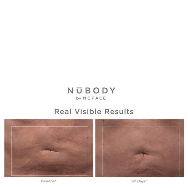 NuBODY 美体仪商品第7张图片规格展示