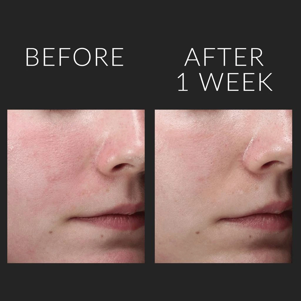 商品Kate Somerville|Kx Active Concentrates,价格¥723,第3张图片详细描述