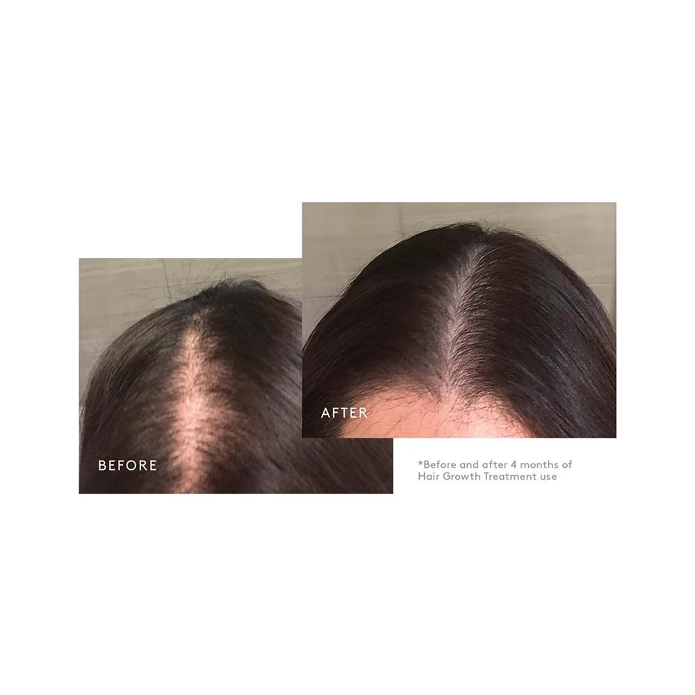 3-Pc. Trial-Size Hair Growth Treatment Set 商品
