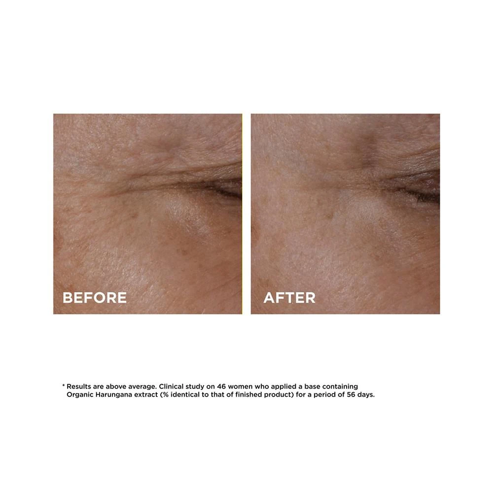 Total Eye Lift Firming & Smoothing Anti-Aging Skincare Set 商品