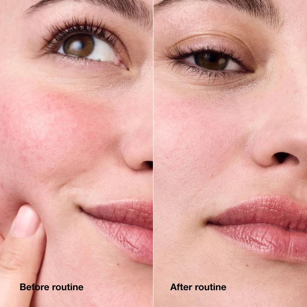 商品Clinique|Redness Solutions Daily Relief Cream With Probiotic Technology,价格¥480,第3张图片详细描述