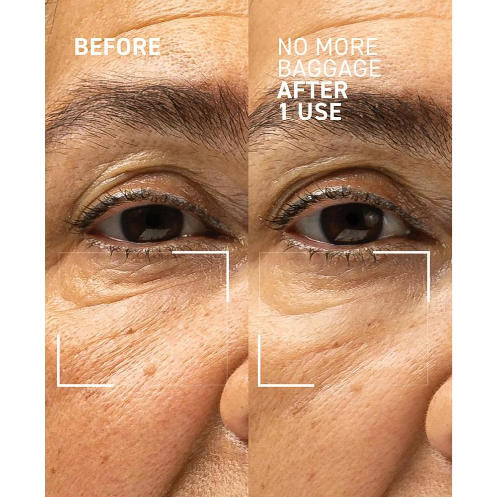 Needles No More No More Baggage Eye Gel, 0.5 oz. 商品