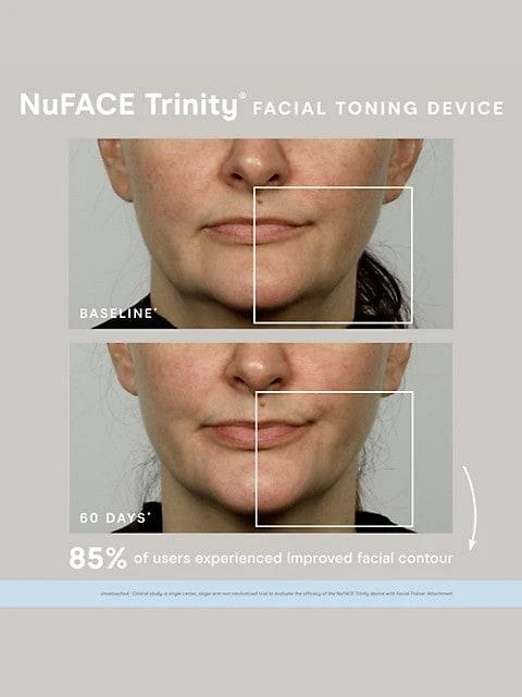 商品NuFace|Trinity Microcurrent 4-Piece Device & Skin Care Set,价格¥2573,第3张图片详细描述