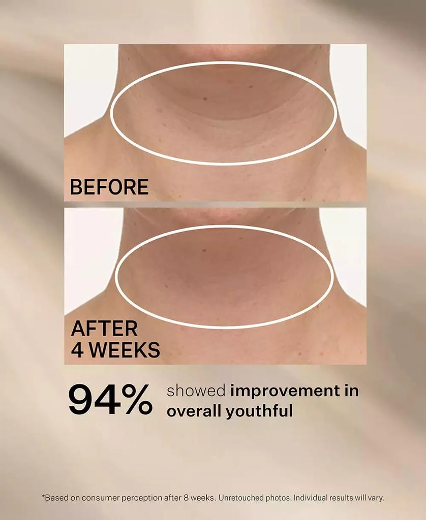 TL Advanced Tightening Neck Cream Plus With Alpha-3 Peptide, 3.4 oz. 商品